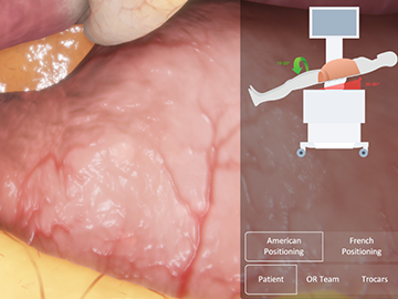 Virtamed LaparoS - Start with patient safety module